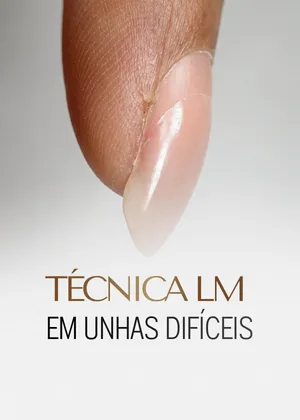 Módulo: técnica LM em unhas difíceis